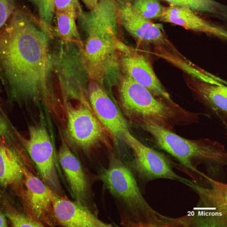 Human Multipotent Cord Blood Unrestricted Somatic Stem Cells