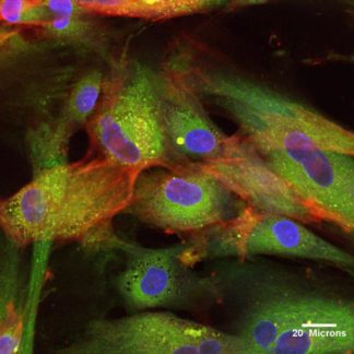 Human Wharton's Jelly Mesenchymal Stem Cells