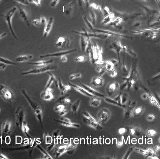 Endothelial Progenitor Cell Differentiation Media