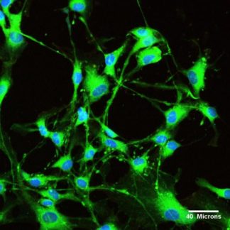 Neural Differentiation Media
