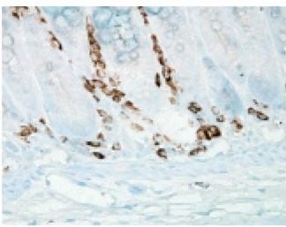 Immuno Histo Chemistry - Nitrotyrosine 160 Slides Kit