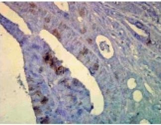 Immuno Histo Chemistry -Hsp70 (160 Slides Kit)