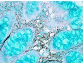 Immuno Histo Chemistry - Hsc70      160 Slides Kit