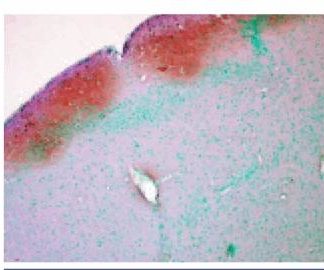 Immuno Histo Chmistry - CamKIIphospho   160 Slides Kit