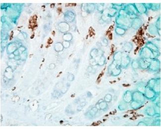 Immuno Histo Chemistry - DNA Damage and Nitrotyrosine   160 Slides Kit