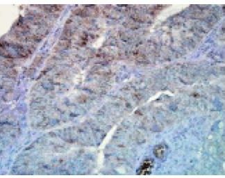 Immuno Histo Chemistry - Hsp90alpha   160 Slides Kit