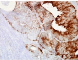 Immuno Histo Chemistry - Hsp90beta    160 Slides Kit