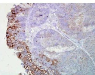 Immuno Histo Chemistry - Hsp90 (Total)     160 Slides Kit