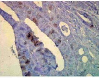 Immuno Histo Chemistry - Hsp70/Hsc70 and Hsp70   160 Slides Kit