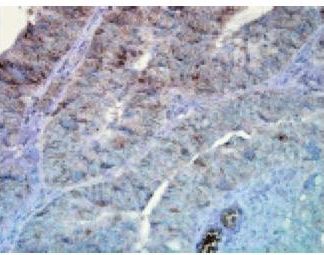 Immuno Histo Chemistry - Hsp90alpha and Hsp90beta   160 Slides Kit