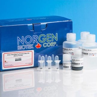Urine Total RNA Purification Maxi Kit (Slurry Format) (Cat. 29600, 29650)