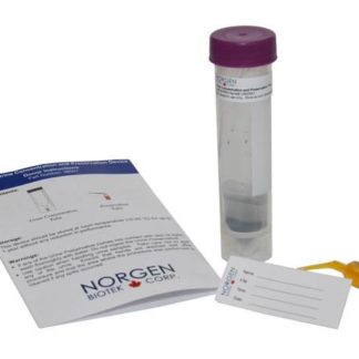Urine RNA Concentration, Preservation and Isolation Kit