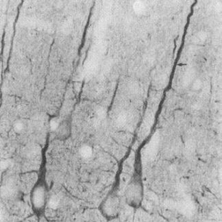 PSD Mouse Monoclonal Antibody (Clone 7E3-1B8)