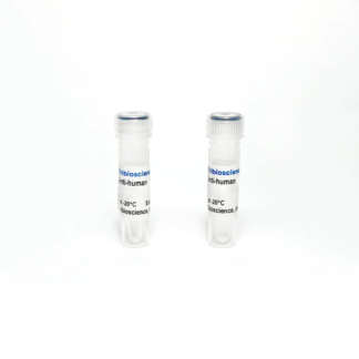 Human Adrenocorticotropic Hormone (ACTH) Monoclonal Antibody
