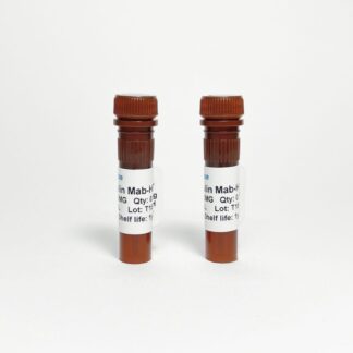Human ACTH Monoclonal Antibody HRP