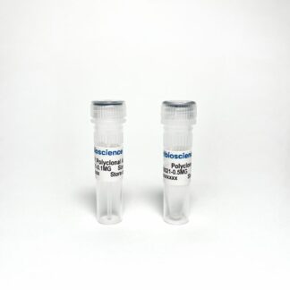 Phospho-Tau Thr231 (p-tau231) Polyclonal Antibody Validated as capture in ELISA