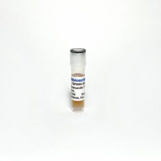 Glutamic Oxaloacetic Transaminase (AST)
